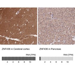 ZNF436 Antibody, Novus Biologicals 0.1mL; Unlabeled:Antibodies, Polyclonal